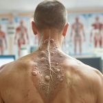 Ganglion dans le dos : Comprendre ce Symptôme